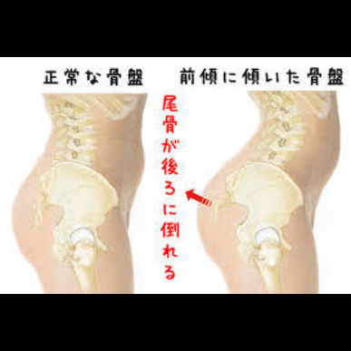 頭蓋骨を調整する事によって反り腰を改善してみませんか？